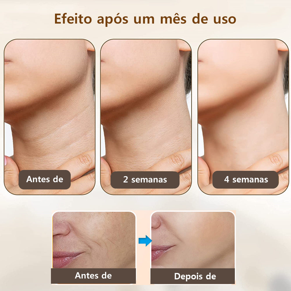Neck Anti-Wrinkle Massager for Rejuvenation & Care